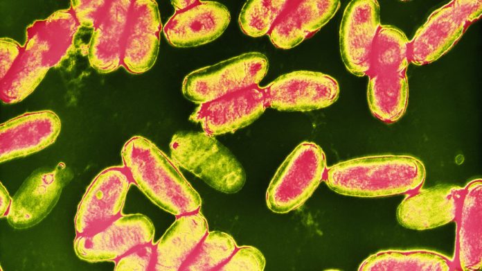 pertussis